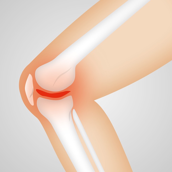Когда нужна артроскопия коленного сустава?