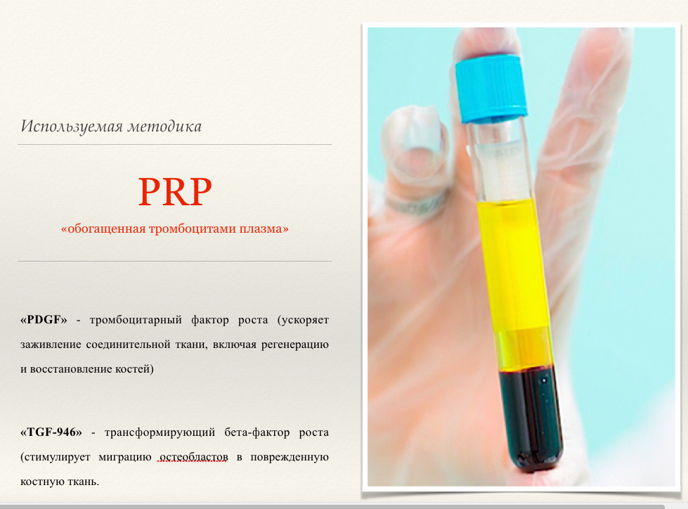 PRP - плазмолифтинг